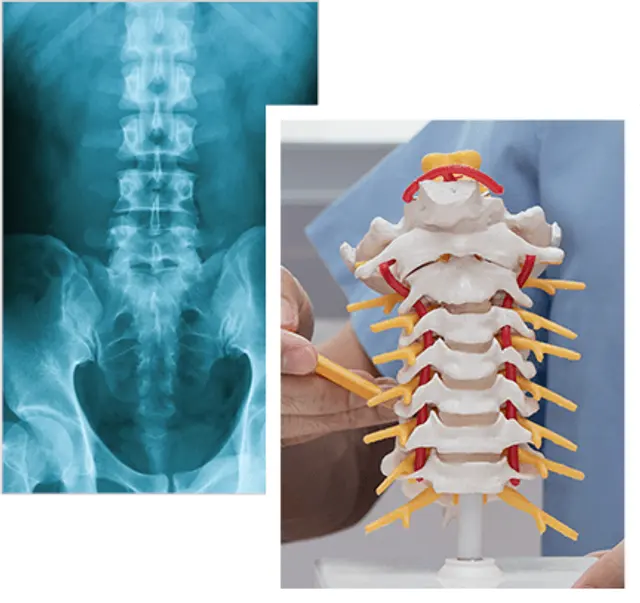 Surgery or Second Opinion